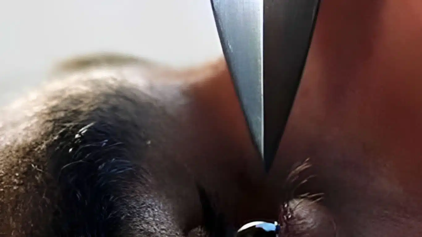 A knife just a few millimeters away from Ethan’s retina